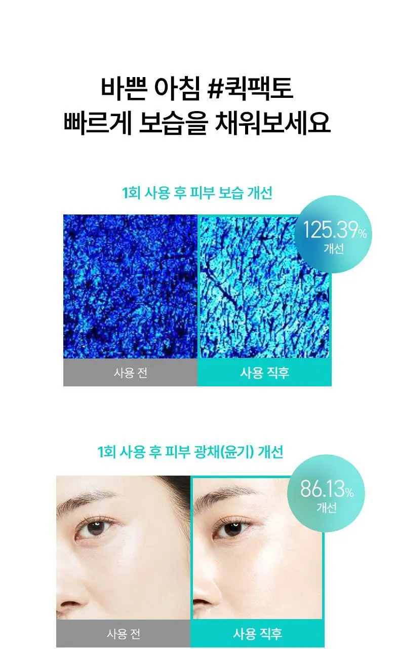 [올영단독] 아누아 패드 리필 기획 3종(어성초/피디알엔/카테킨) 상세페이지 29